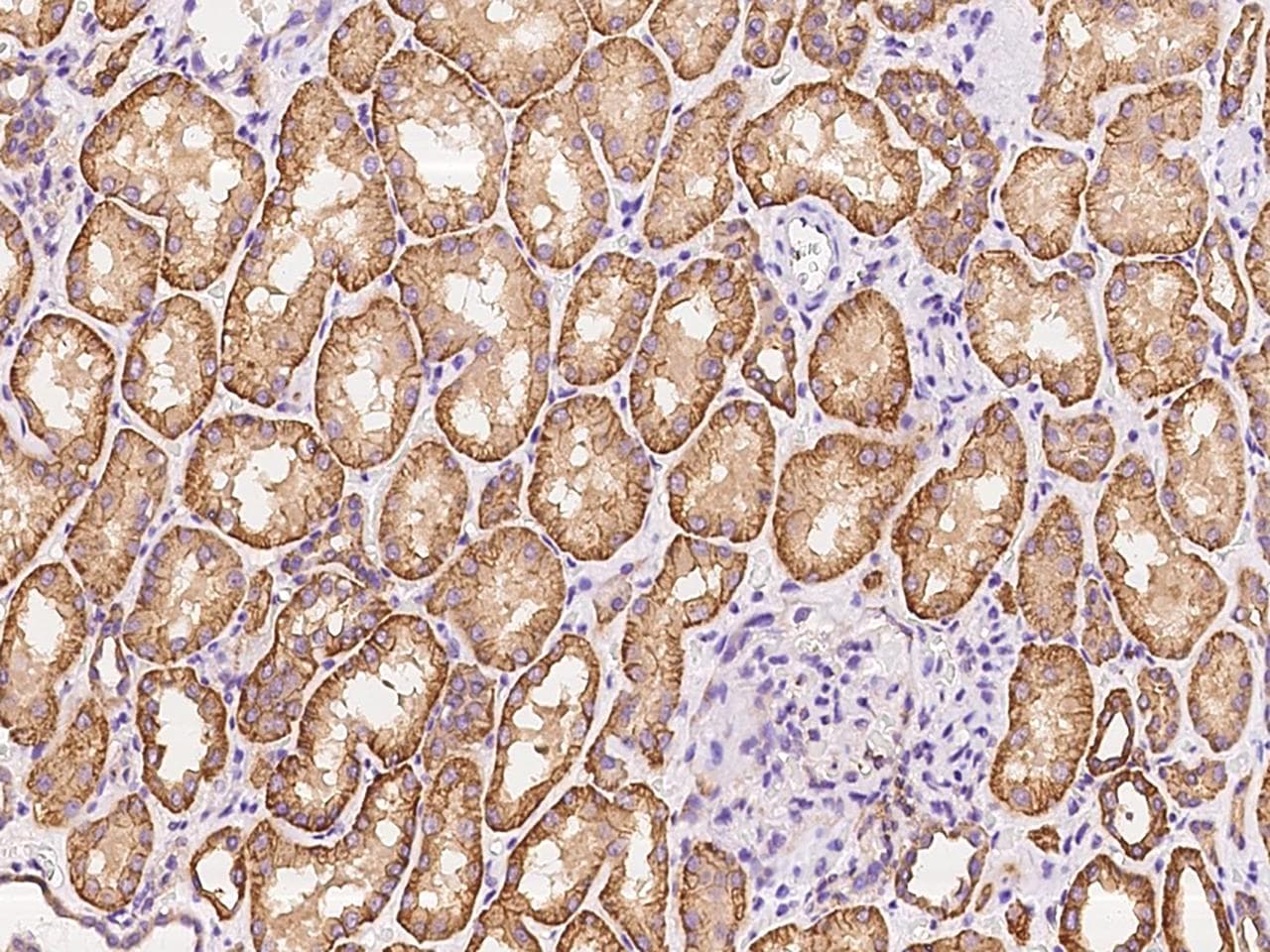 Polyclonal Rabbit anti-Human ZNF248 Antibody (IHC)