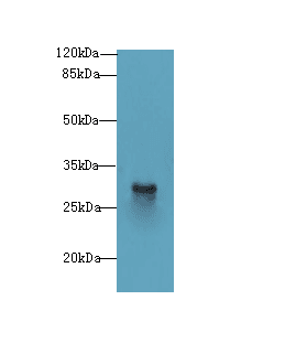 SNRNP35 Antibody