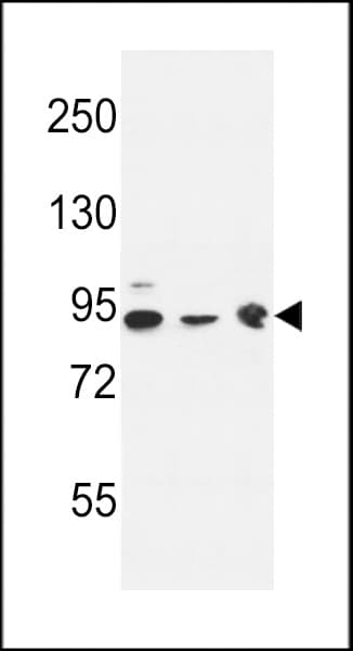 DNAJC6 Antibody (aa254-281)