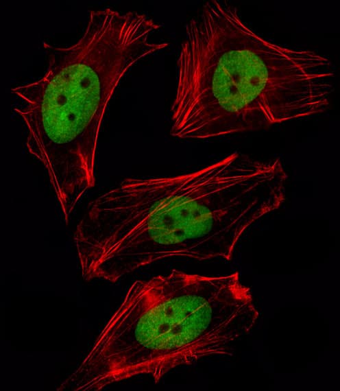 IHC-plus™ FOXD1 Antibody (aa1-30)