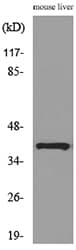 ALDOC / Aldolase C Antibody