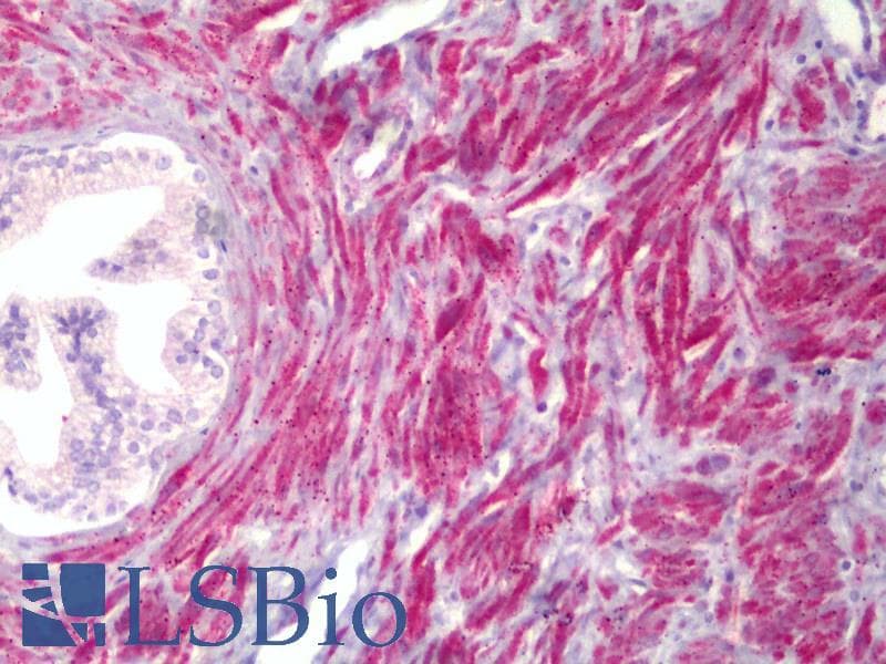 IHC-plus™ TMEPAI / PMEPA1 Antibody (aa101-150)