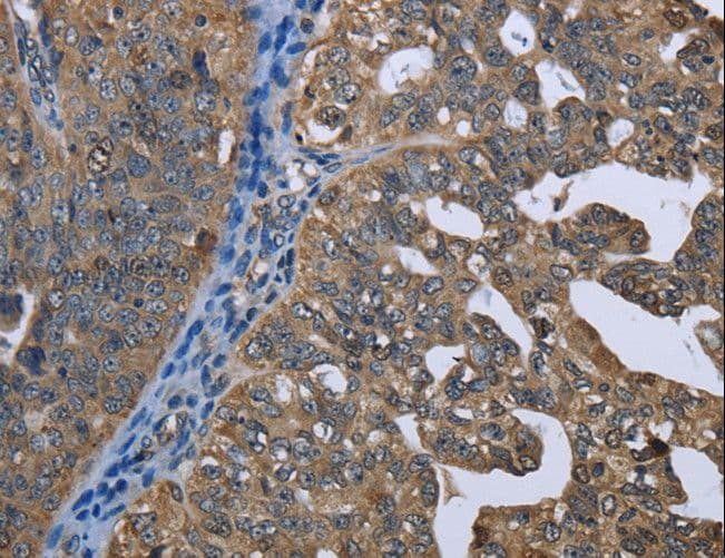 Polyclonal Rabbit anti-Human GPAM Antibody (IHC)