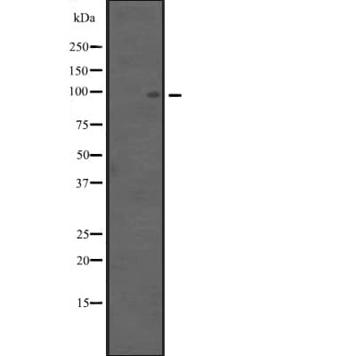 Polyclonal Rabbit anti-Human APC4 / ANAPC4 Antibody (WB)