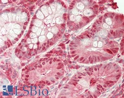 IHC-plus™ Polyclonal Rabbit anti-Human GSTP1 / GST Pi Antibody (aa 2-210, IHC, WB)