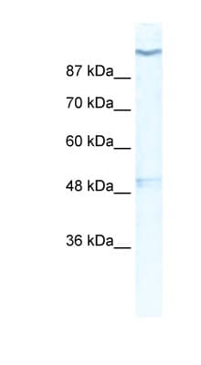 Polyclonal Rabbit anti-Human KCNH6 / Kv11.2 / ERG2 Antibody (aa628-677, IHC, WB)