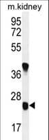 UNC119B Antibody (aa207-236)