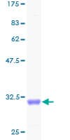 Human COL4A6 / Collagen IV Protein (Recombinant GST)