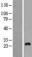 EMC3 Protein (Over-Expression Lysate Myc-DDK (Flag))