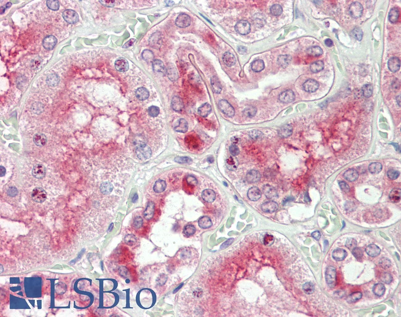 IHC-plus™ RGS22 Antibody