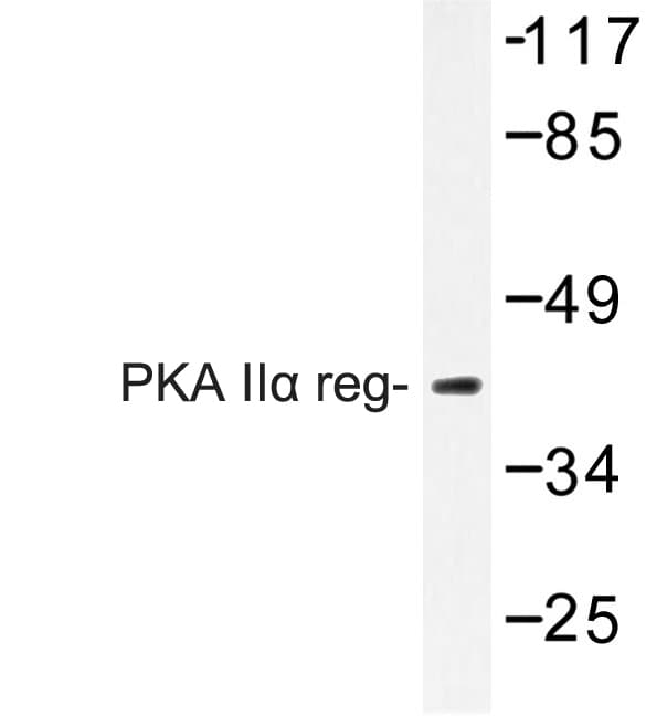 Polyclonal Rabbit anti-Human PRKAR2A Antibody (Pro68, IHC, IF, WB)