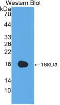 F8 / FVIII / Factor VIII Antibody (aa1669-1824)