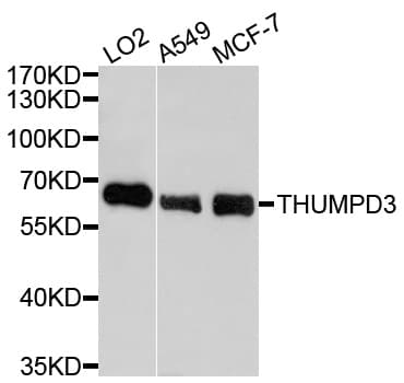 Polyclonal Rabbit anti-Human THUMPD3 Antibody (WB)