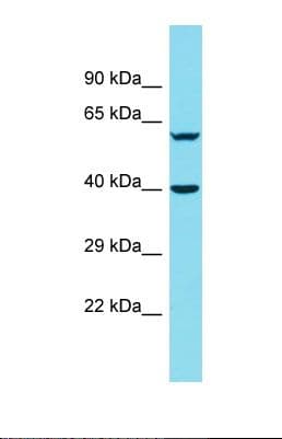 Polyclonal Rabbit anti-Human DNAJB14 Antibody (aa69-118, WB)