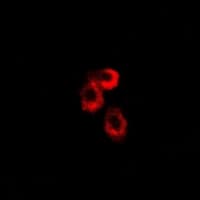 Polyclonal Rabbit anti-Human UQCRFS1 Antibody (IF, WB)