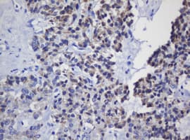 MRPL11 Antibody (clone OTI1E5)