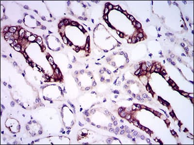 Monoclonal Mouse anti-Human ALK3 / BMPR1A Antibody (clone 4B7B2, aa179-378, IHC, WB)