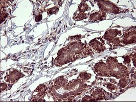 POMC / Proopiomelanocortin Antibody (clone OTI2B2)