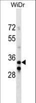 Polyclonal Rabbit anti-Human ITGB1BP2 / MELUSIN Antibody (aa270-297, WB)