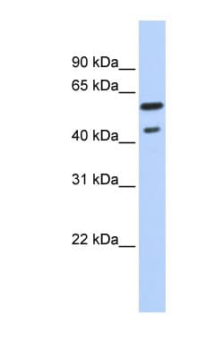 NR1A2 / THRB Antibody (C-Terminus)
