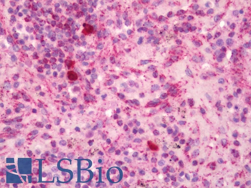 IHC-plus™ Polyclonal Rabbit anti-Human MRPL41 / PIG3 / BMRP Antibody (aa81-130, IHC, WB)