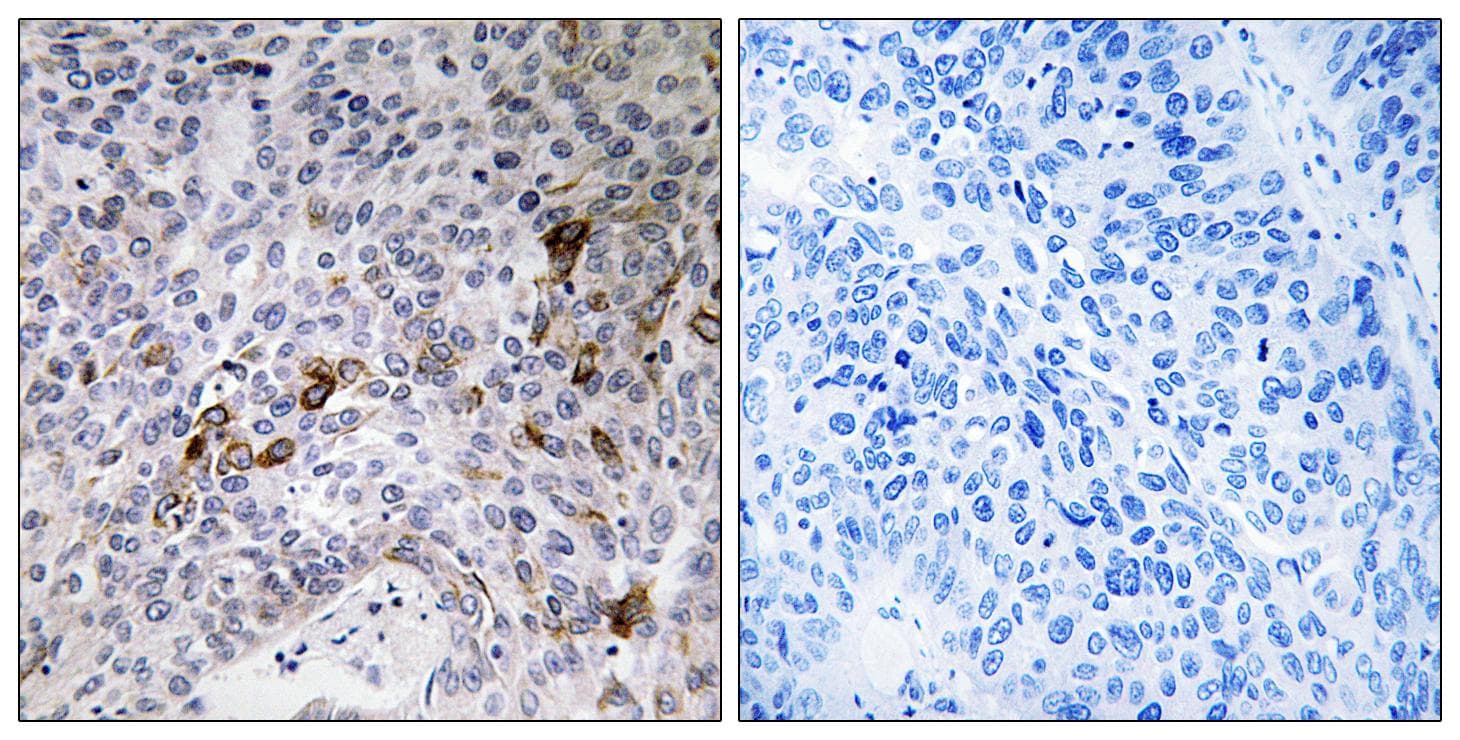 RAB11FIP3 Antibody