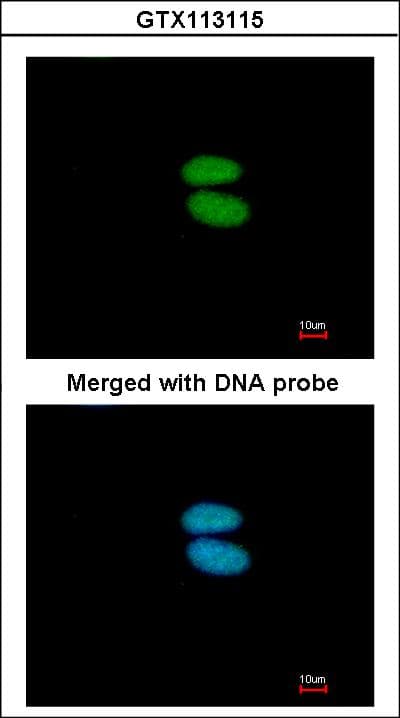 ACTN4 Antibody (aa206-542)