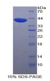 Human UGT8 Protein (Recombinant His)