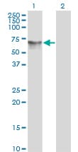 IHC-plus™ HDAC1 Antibody (clone 1D6)