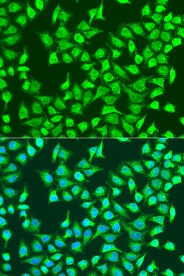 SIRT4 / Sirtuin 4 Antibody
