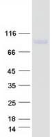 Human GIT1 Protein (Recombinant Myc-DDK (Flag))