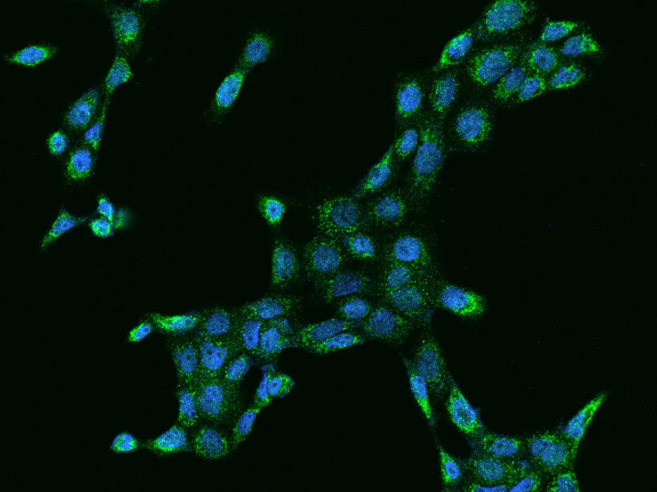 MCCC2 / MCCB Antibody
