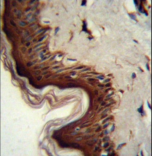 PPL / Periplakin Antibody (aa1301-1330)
