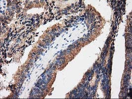 PRKAR2A Antibody (clone OTI1F8)