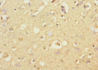 Polyclonal Rabbit anti-Human STRADA / LYK5 Antibody (IHC)
