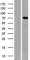 Human KLHL31 Protein (Over-Expression Lysate Myc-DDK (Flag))