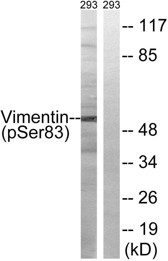 Polyclonal Rabbit anti-Human Vimentin Antibody (phospho-Ser83, IHC, WB)