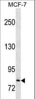 CTNNB1 / Beta Catenin Antibody (aa646-673, clone 516CT4.3.3)