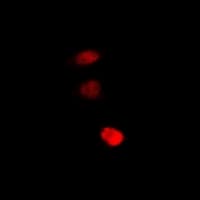 Polyclonal Rabbit anti-Human STAMBP / AMSH Antibody (IHC, IF, WB)