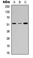 Polyclonal Rabbit anti-Human F9 / Factor IX Antibody (Internal, WB)