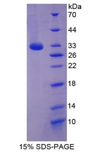 Human MAPK10 / JNK3 Protein (Recombinant His-T7)