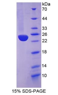 Human HMOX1 / HO-1 Protein (Recombinant His-S)