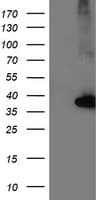 NUDT18 Antibody (clone OTI6B7)