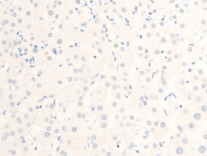 Polyclonal Rabbit anti-Human MITF Antibody (phospho-Ser180,phospho-Ser73, IHC, IF, WB)