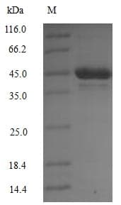 Mouse PDK1 Protein (Recombinant 10His, N-terminus)