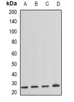 TSC501 / NAT8 Antibody