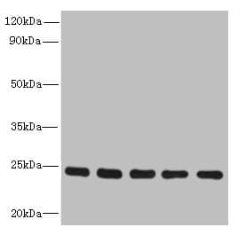 Polyclonal Rabbit anti-Human RAB6B Antibody (IHC, WB)