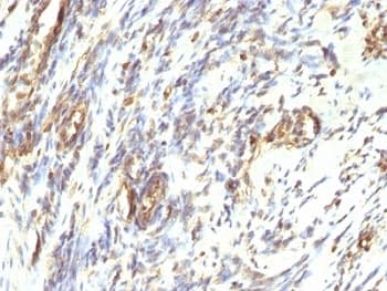 Vimentin Antibody (clone VM1170)