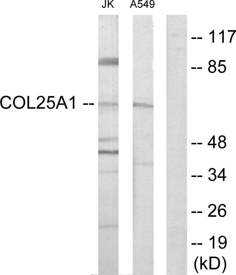 COL25A1 / Collagen XXV Antibody