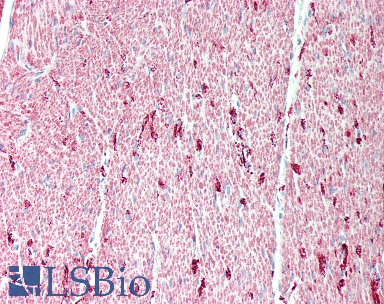 PathPlus™ DES / Desmin Antibody